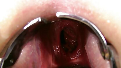 Kinkynikky Prolaps xo Spekulum anal free german sexmovies